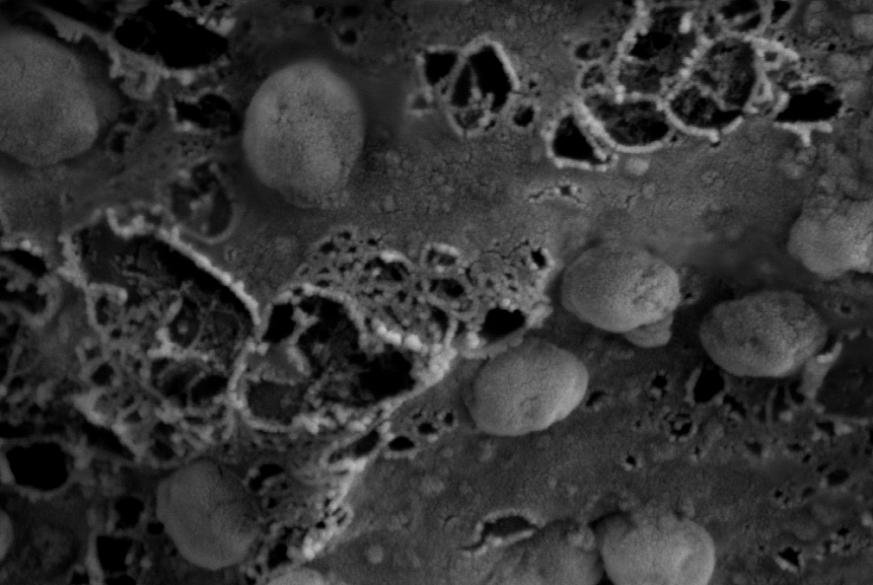 A high-powered microscope image showing exosomes, nanosized parts of cells. 