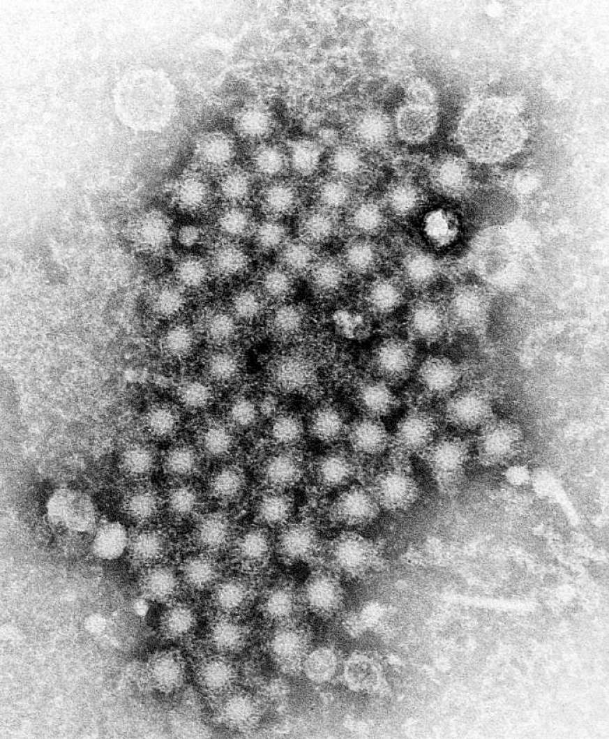 A cluster of circular hepatitis virus particles, as captured by a transmission electron microscope