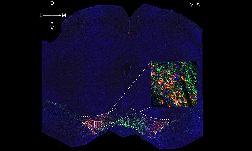 Brain slice containing ventral tegmental area where dopamine neurons are expressing excitatory virus 