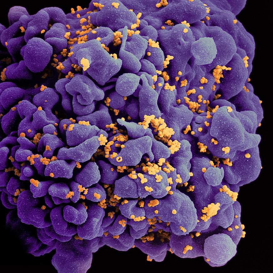 HIV-infected H9 T Cell