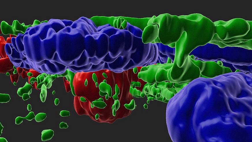 3D illustration of RPE cells and drusen