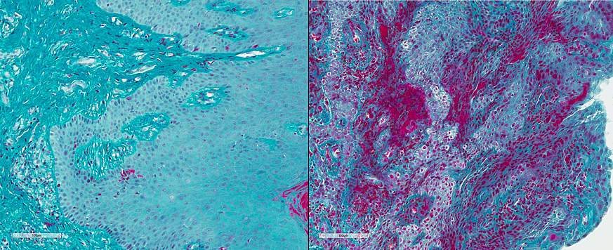 A fluorescence microscopy image of human gum tissue. 