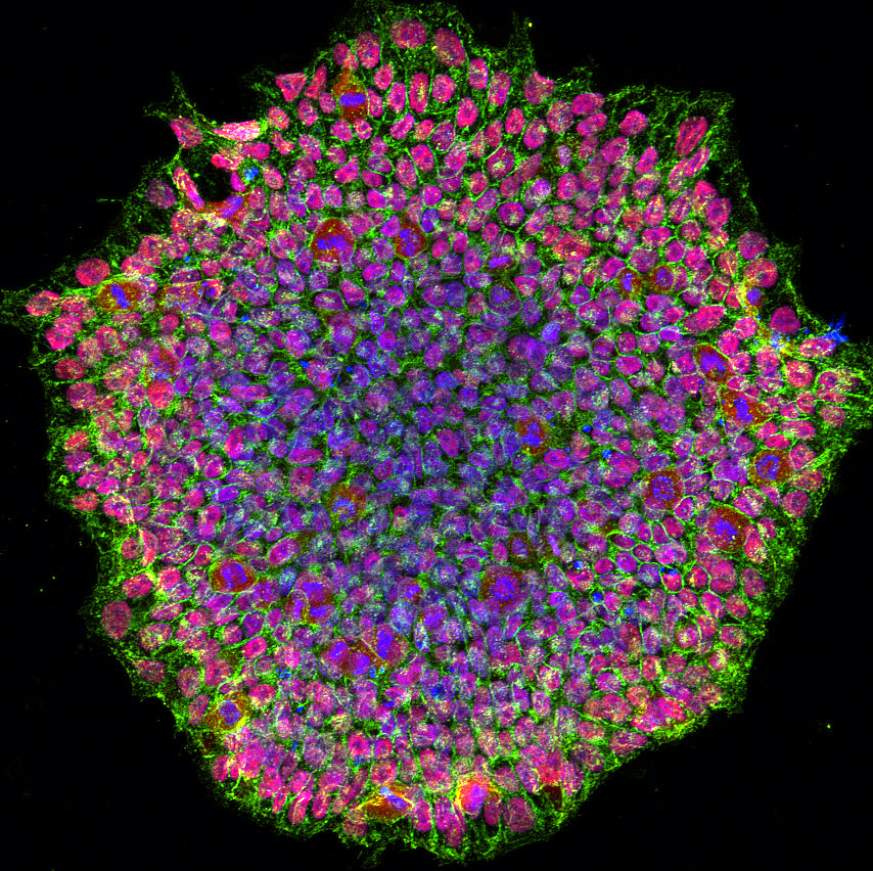 Group of cells tinted purple in the middle and pink at the edges