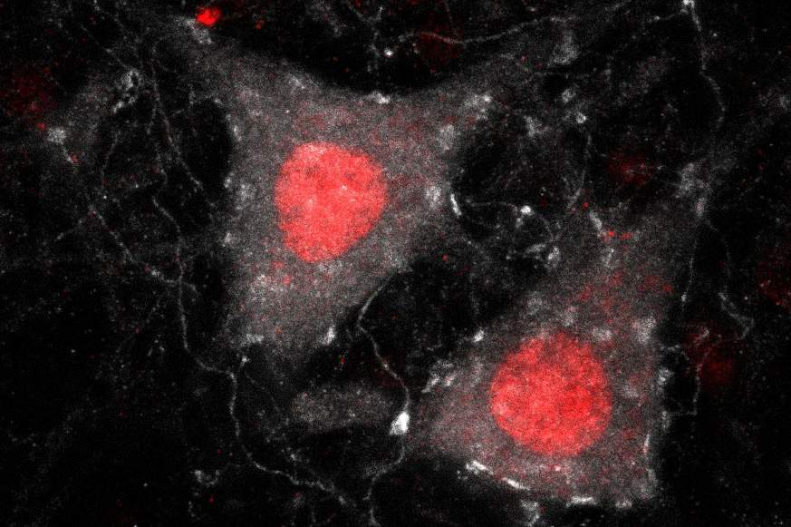 Picture of two neurons from a mouse spinal cord.