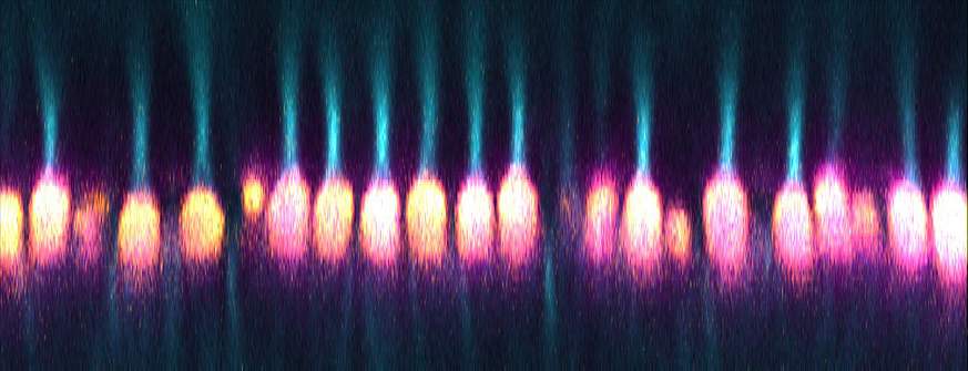 Image of a microscope scan of optical nerves