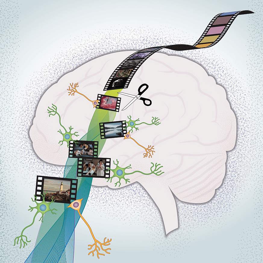 Illustration of a brain with photographs.