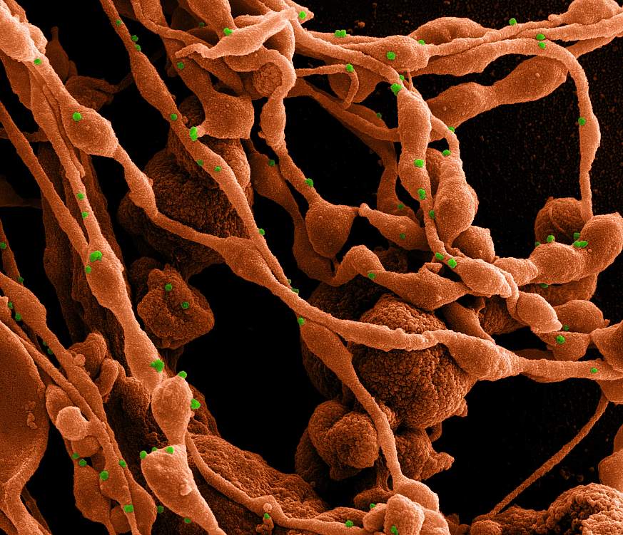 Novel Coronavirus SARS-CoV-2