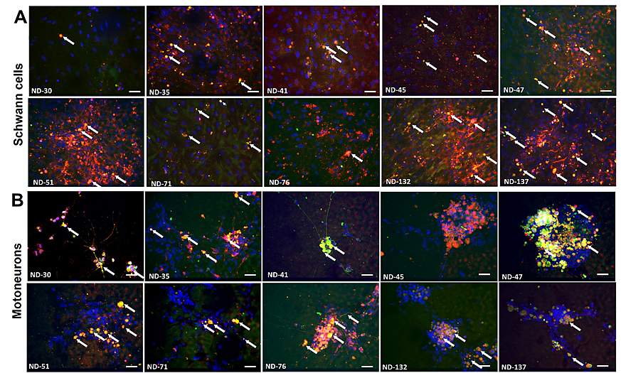 Antibodies attach to Schwann cells and motoneurons.