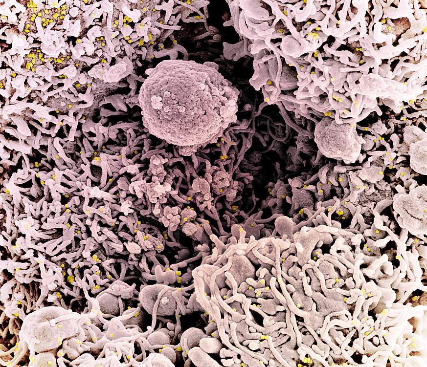 Colorized scanning electron micrograph of a cell (pink) infected with a variant strain of SARS-CoV-2 virus particles (UK B.1.1.7; gold), isolated from a patient sample.