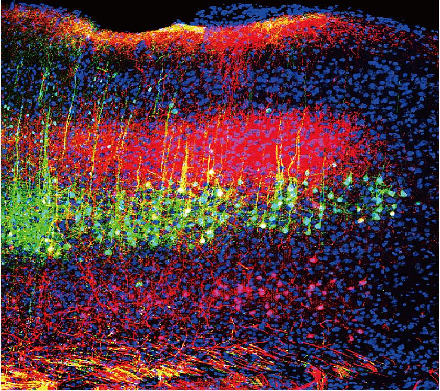 Image of green and magenta neurons in mouse auditory cortex