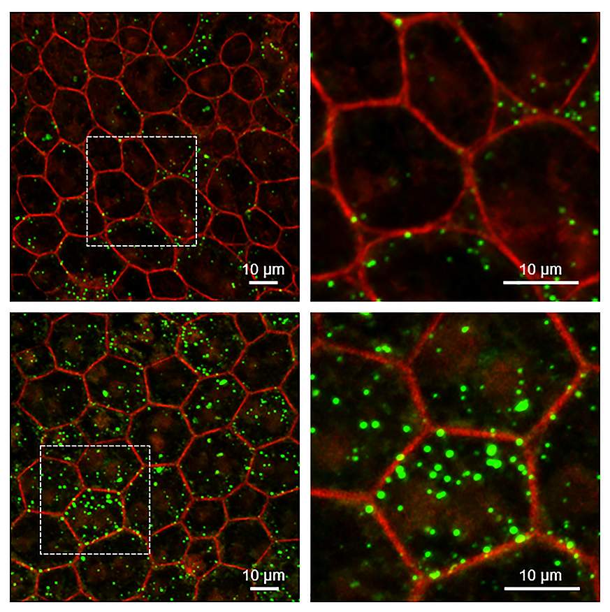 Microscopic images magnified of cell tissue