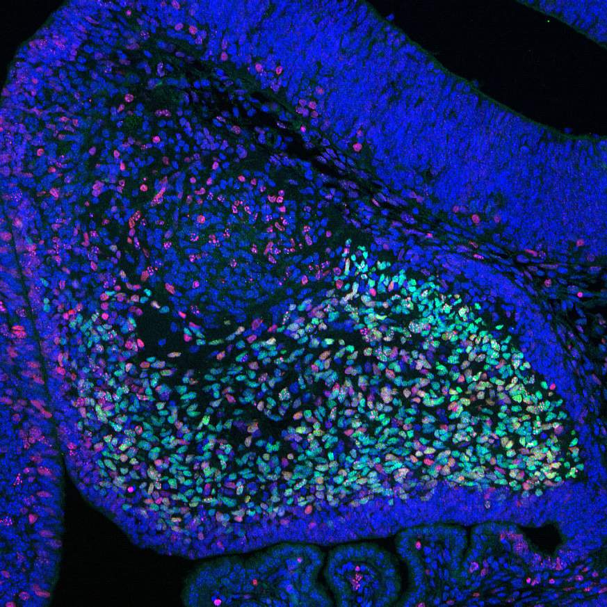 Mouse Embryo Cerebellum