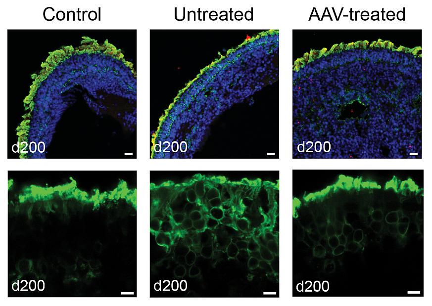 Grid with six images of retinal organoids stained blue red and green