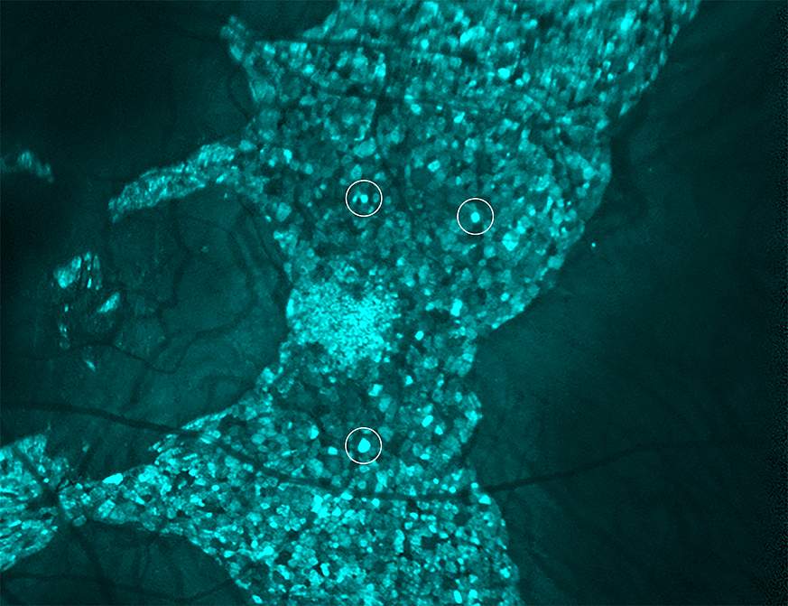 Scan of RPE cells