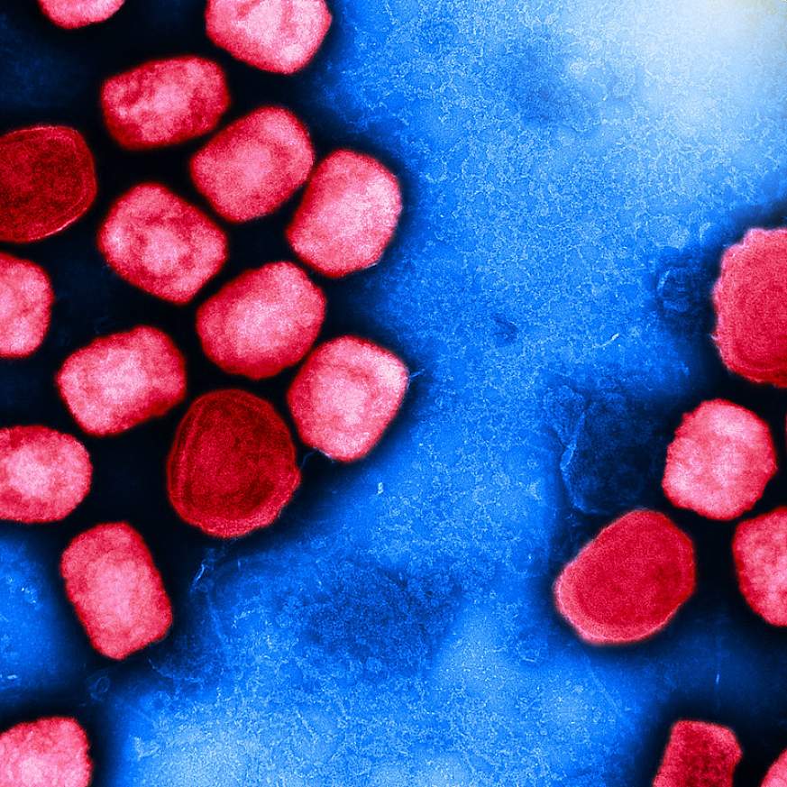 Monkeypox Virus