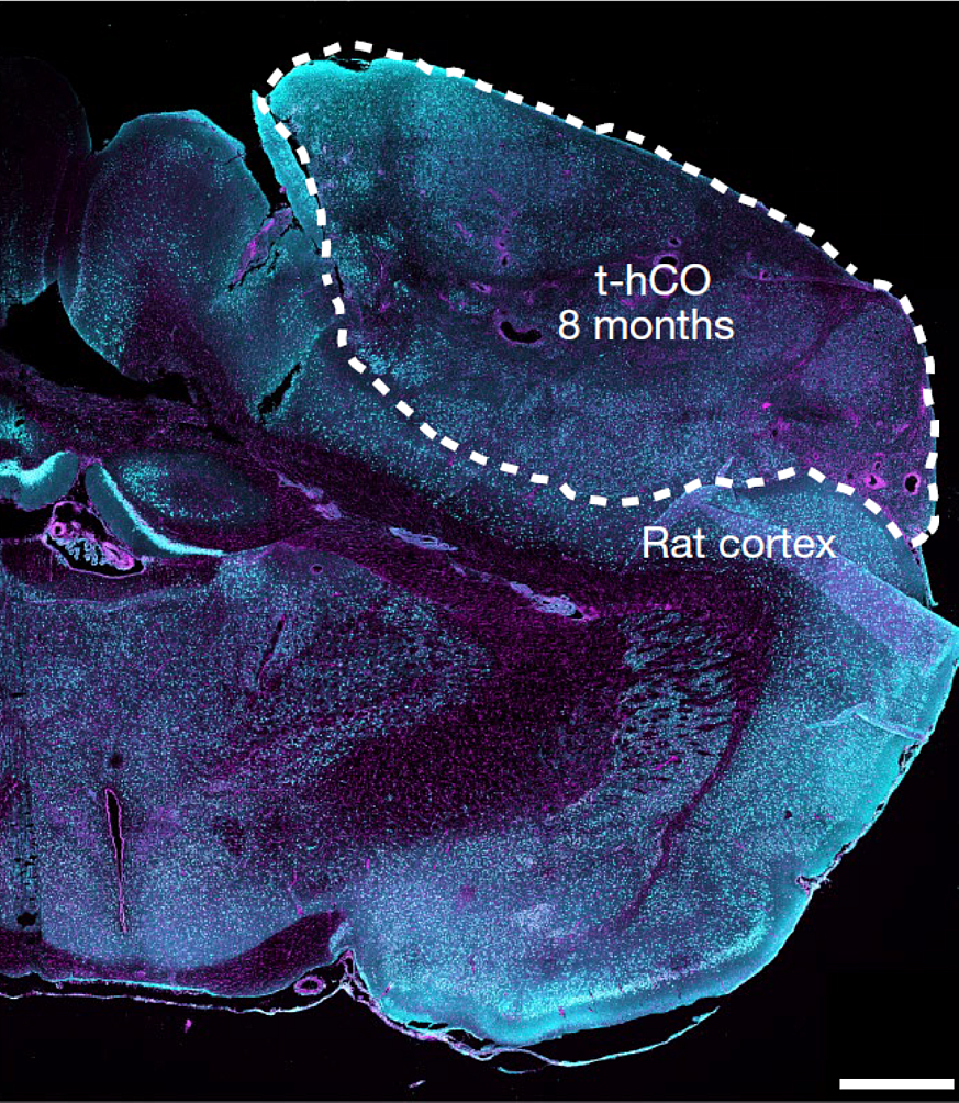 Image of a t-hCO in a rat cortex