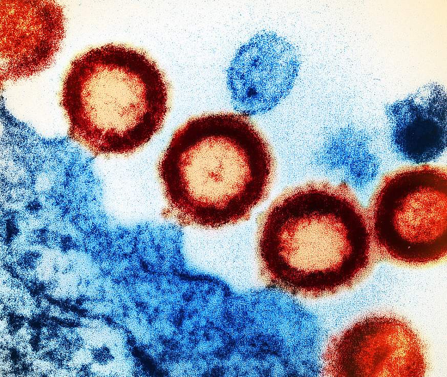 HIV-1 Virus