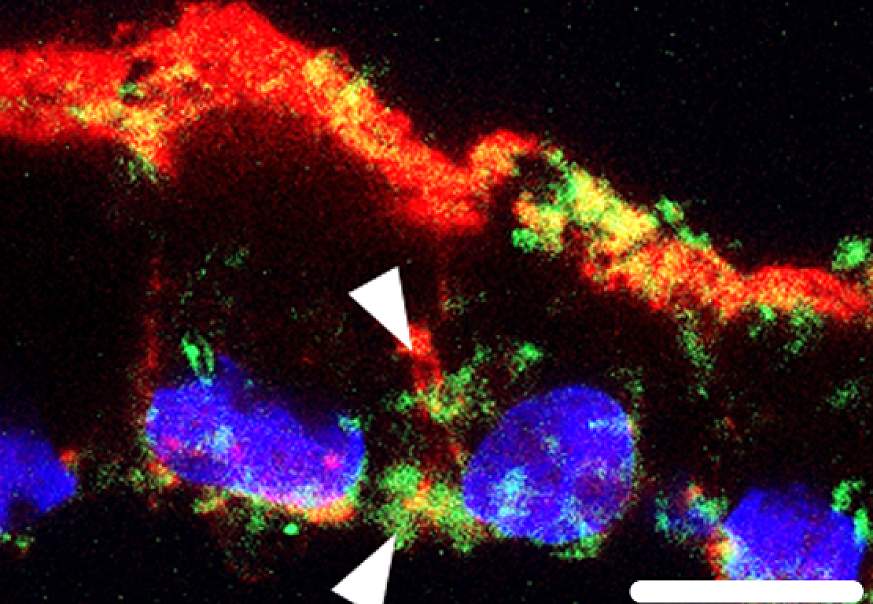 scientific image of stem-cell generated RPE showing lipid deposits in green