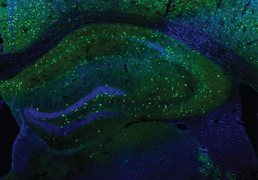 scientific image showing interneurons in green in a mouse brain
