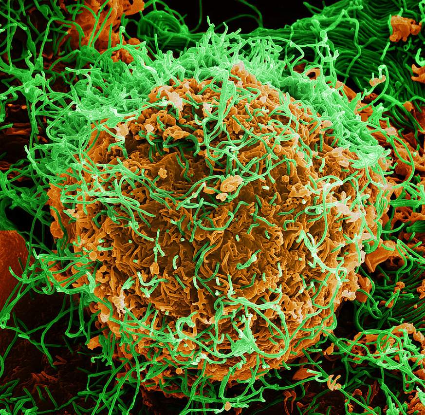 Ebola Virus Particles