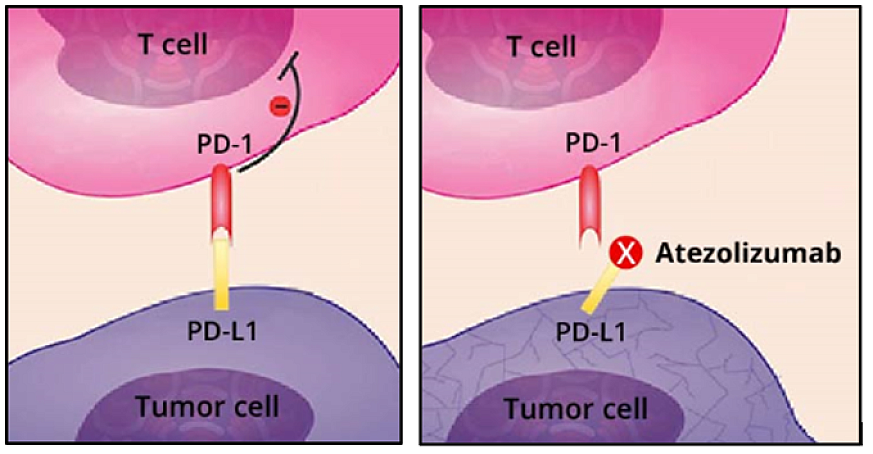 Left frame: Normally, tumor cells (purple) evade the immune system’s T cells (pink) by expressing a checkpoint protein known as PD-L1. Right frame: Atezolizumab (Tecentriq) binds to PD-L1 and blocks it from binding to another checkpoint protein, PD-1. Thi