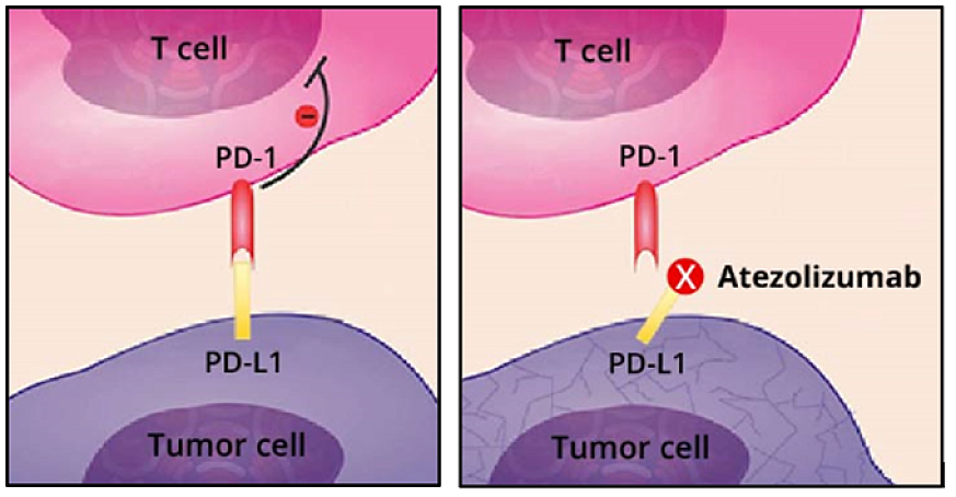 Riquadro sinistro: normalmente, le cellule tumorali (viola) eludono le cellule T del sistema immunitario (rosa) esprimendo una proteina checkpoint nota come PD-L1.  Riquadro destro: Atezolizumab (Tecentriq) si lega a PD-L1 e ne impedisce il legame con un'altra proteina checkpoint, PD-1.  Thi