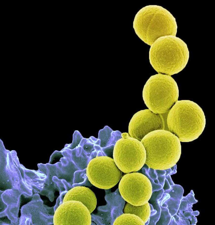 MRSA (yellow) being ingested by neutrophil (purplish blue).