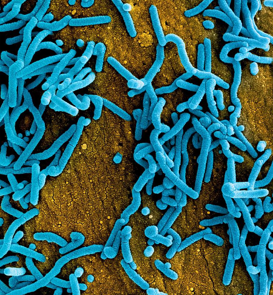 SEM image of rod-shaped Marburg virus particles, colorized blue.