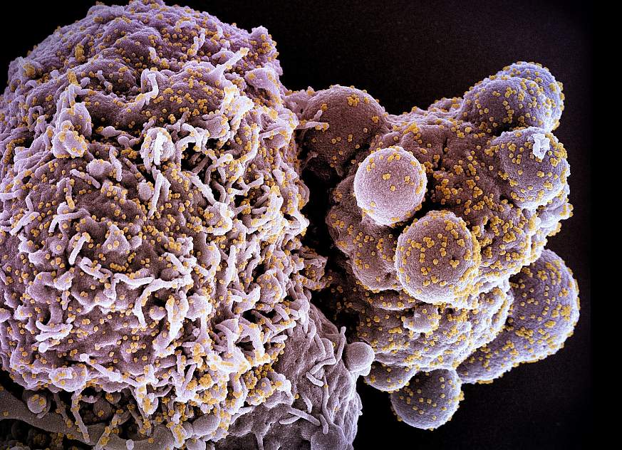 Novel Coronavirus SARS-CoV-2 (Omicron