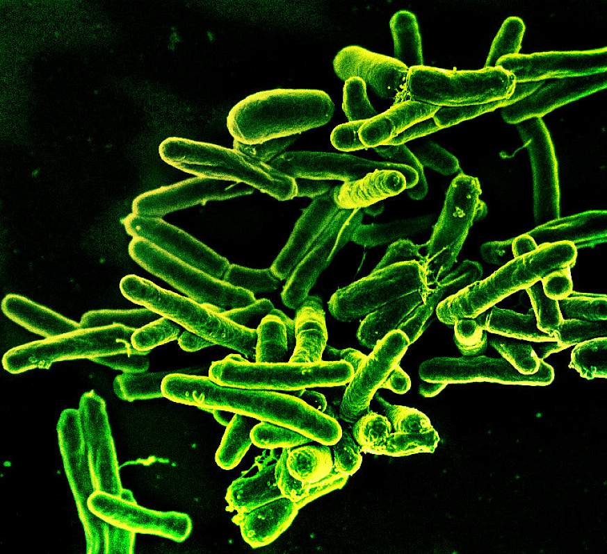 Scanning electron micrograph showing Mycobacterium tuberculosis bacteria (green), which cause TB.