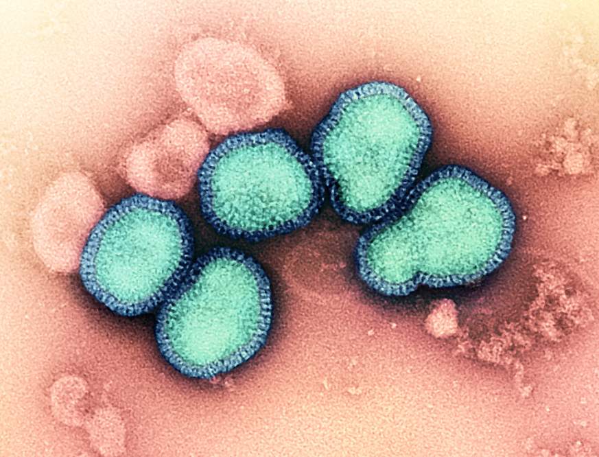 Influenza A Virus (H3N2)