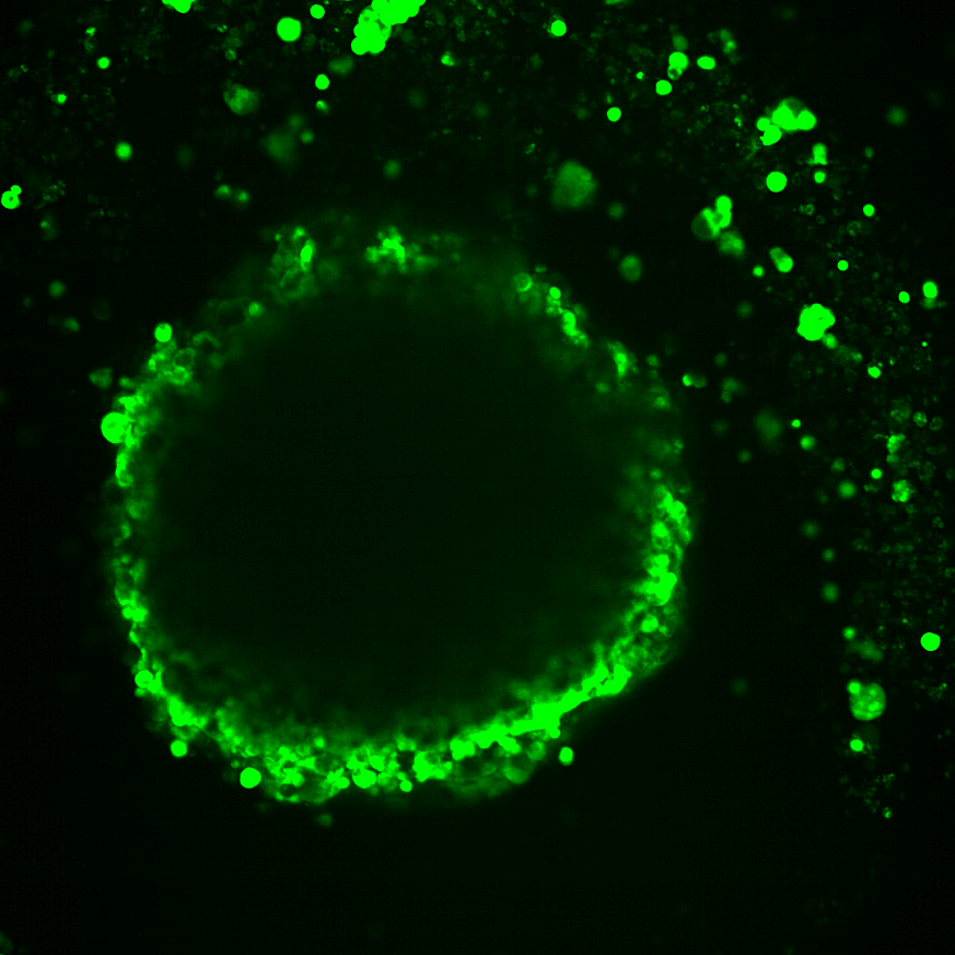 Microscopic image of dyed cells in a tumor model