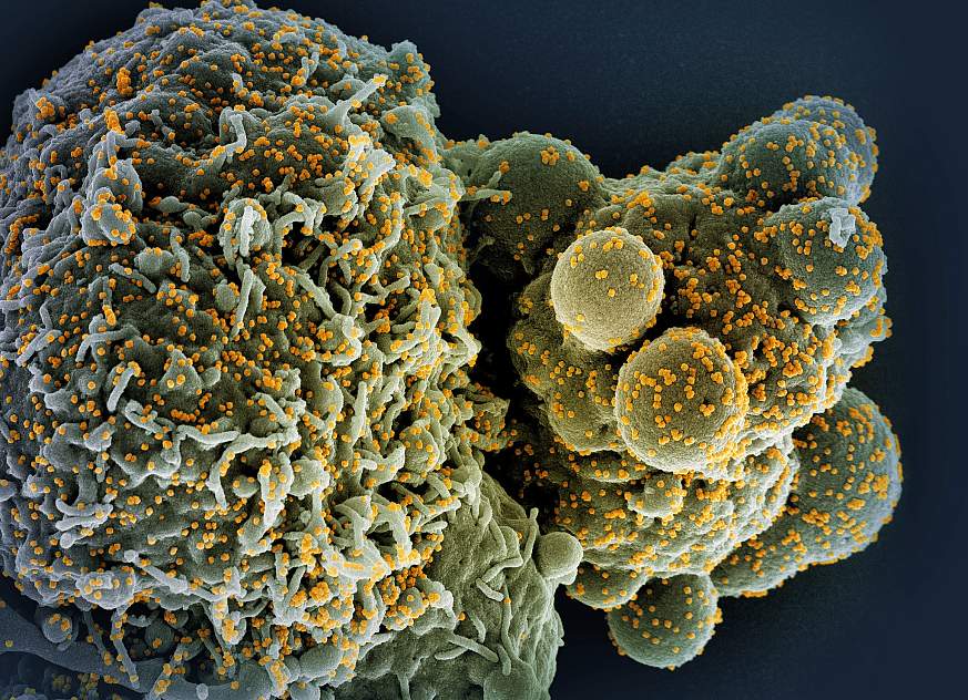 Colorized scanning electron micrograph of a cell (green) infected with the Omicron strain of SARS-CoV-2 virus particles (gold), isolated from a patient sample. Image captured at the NIAID Integrated Research Facility (IRF) in Fort Detrick, Maryland.