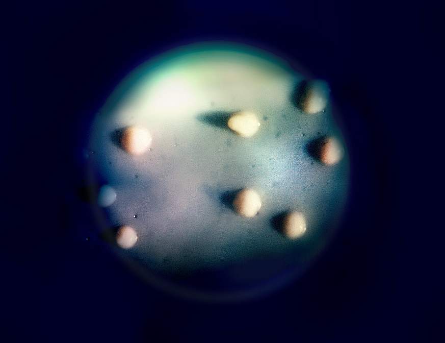 Cultivated colonies of the bacterium Mycobacterium avium appear as eight, round beige objects inside a round petri dish. The dish appears as a faded, dim, blue-green background surrounded by the color black.