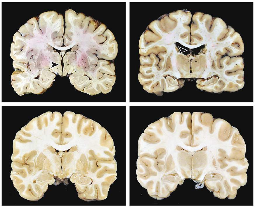 Images of human brain cross sections.