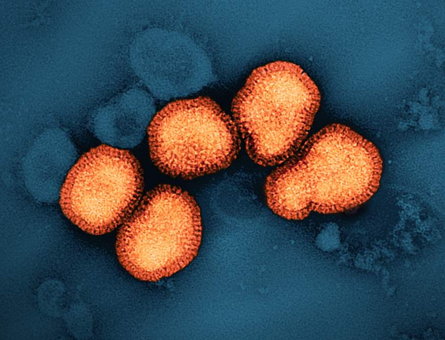 A colorized transmission electron micrograph of circular influenza A virus particles, colorized orange in this image, on a dark blue background.