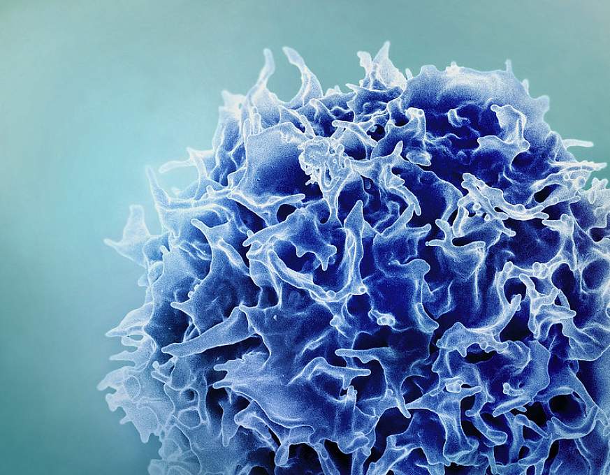 Colorized scanning electron micrograph of a T lymphocyte  (also known as a T cell) (blue). 