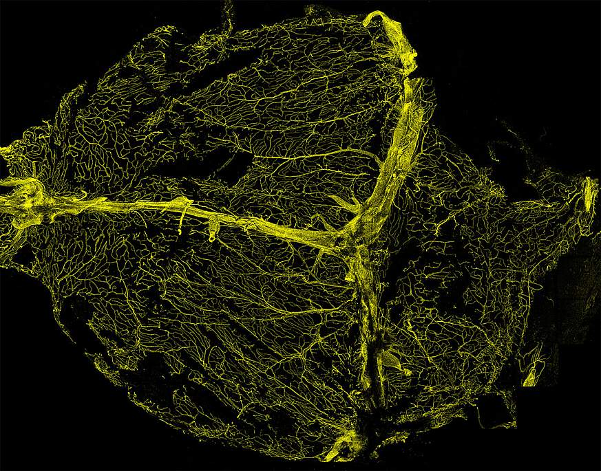 Imagine of florescent staining of the blood vessels in the brain’s dura mater.