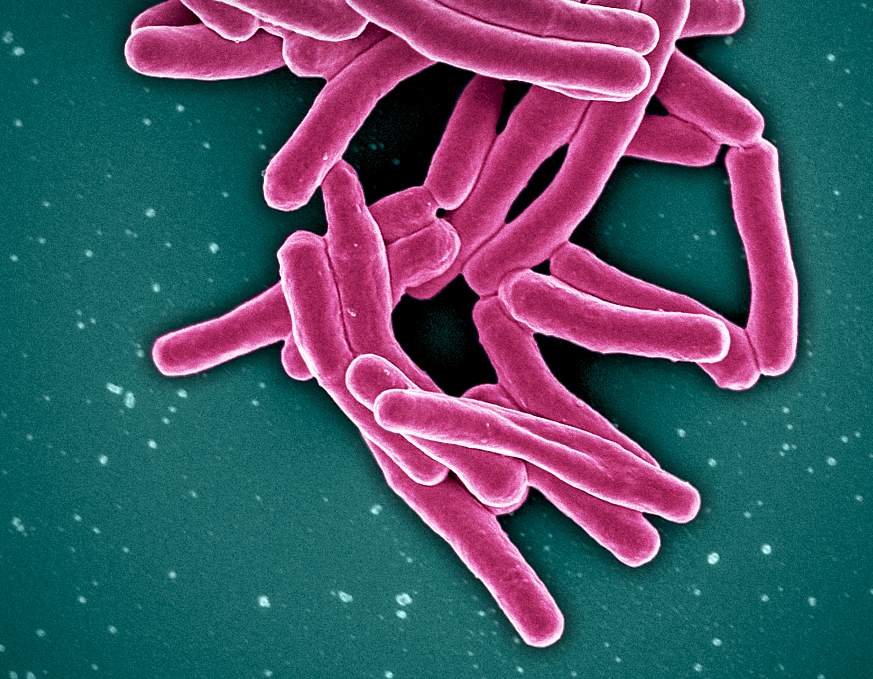 Mycobacterium Tuberculosis Bacteria, the Cause of TB