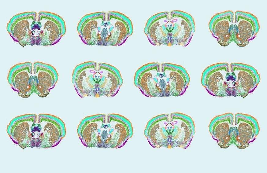 Image compilation showing scans of many mouse brains