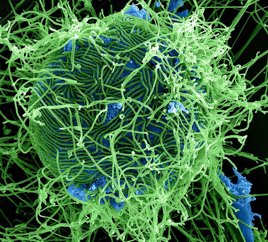 Colorized scanning electron micrograph of filamentous Ebola virus particles (green) attached to and budding from a chronically infected VERO E6 cell (blue) (25,000x magnification).  