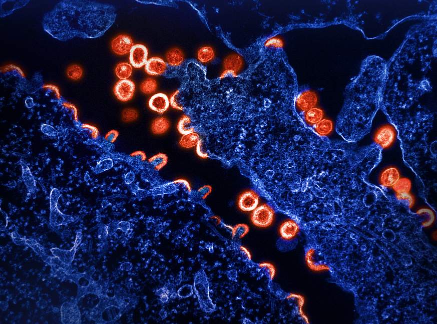 Transmission electron micrograph of HIV-1 virus particles (red) budding and replicating from a segment of a chronically infected H9 cell (blue). Particles are in various stages of maturity; arc/semi-circles are immature particles that have started to form