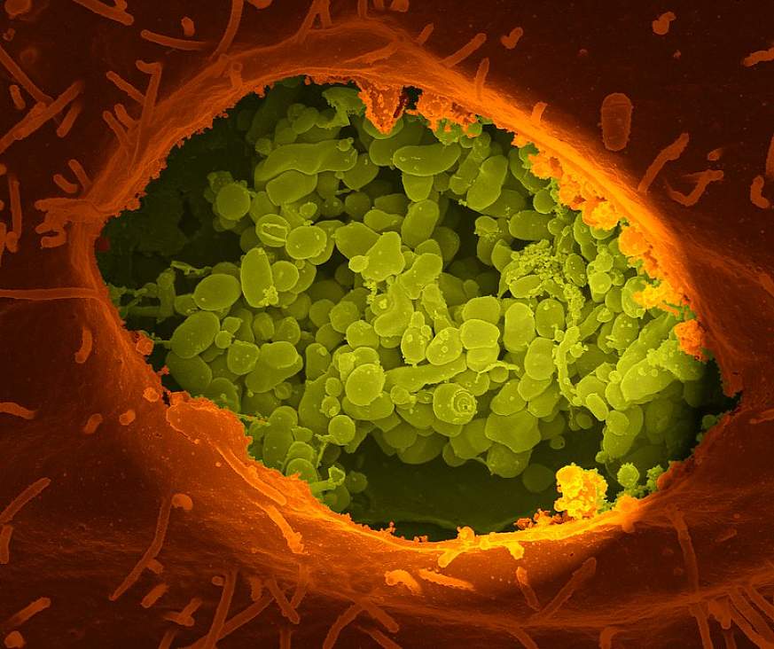 Coxiella burnetii, the Bacteria That Cause Q Fever