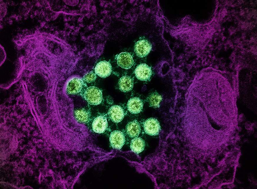 Novel Coronavirus SARS-CoV-2 (Omicron)