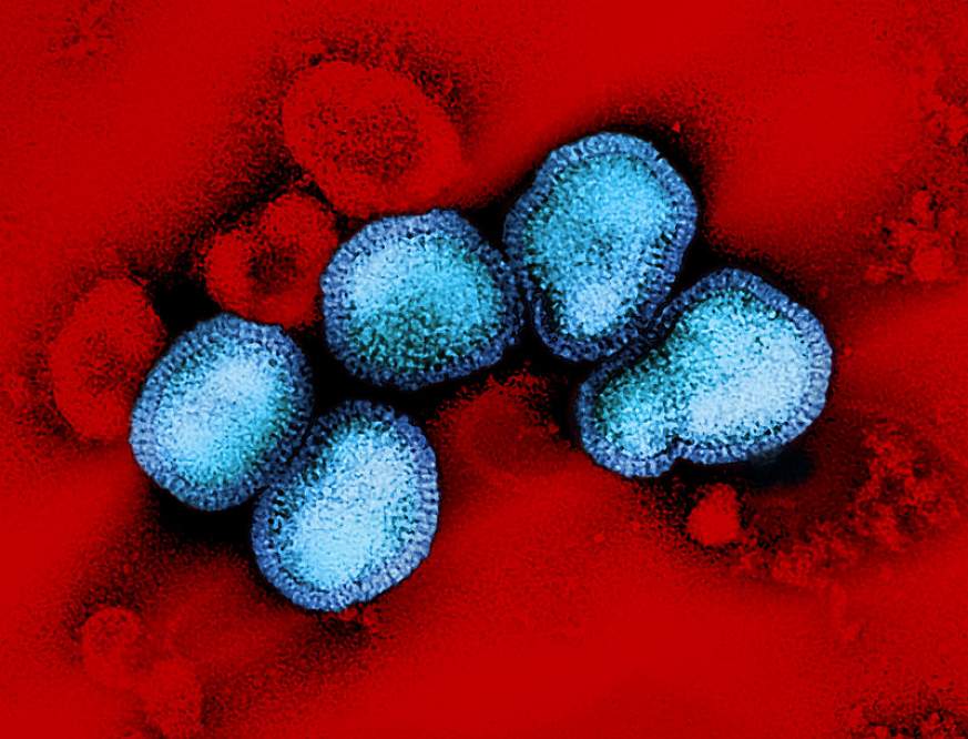 Image of an influenza B virus