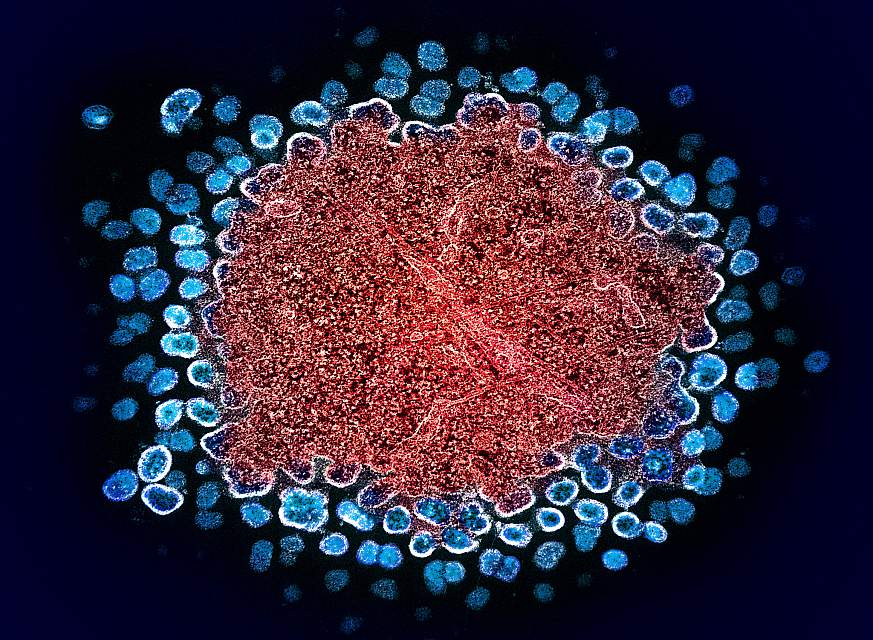 HIV-1 Virus Particles Replicating