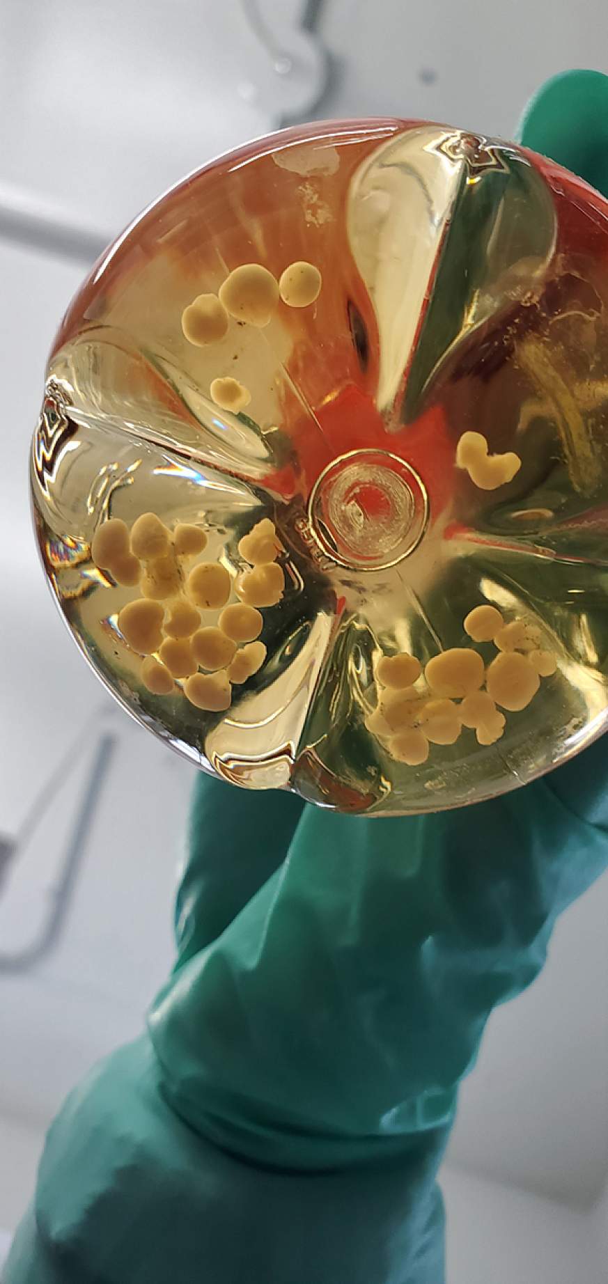 A researcher holds a glass flask containing small spherical human cerebral organoids similar to those used in the CWD study
