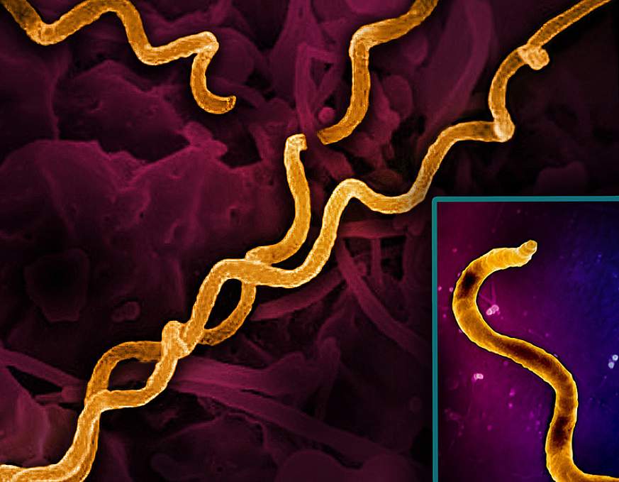 A burgundy background is covered with several spirals. One spiral appears enlarged in a small frame within the image.