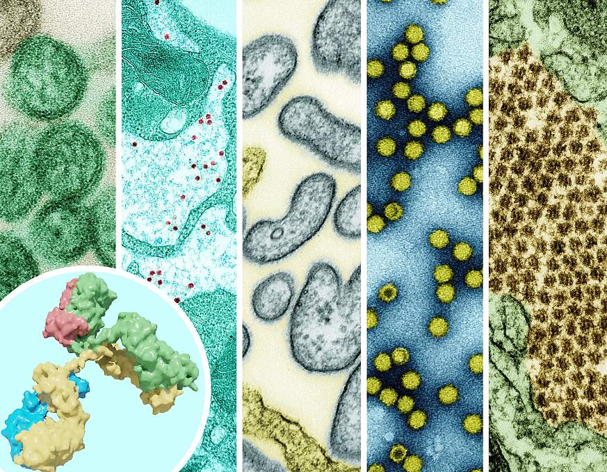 Five different pathogens - yellow fever virus, Nipah virus, Picoronavirus and Chikungunya - are represented by colorized images. In the background, a monoclonal antigen is displayed.