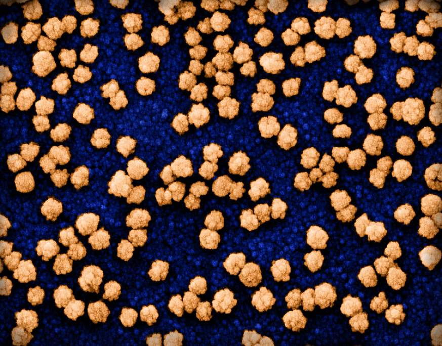 Novel Coronavirus SARS-CoV-2